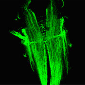 Fluorescence confocal microscopy image of a hindbrain of a Xenopus laevis (frog) using DSHB antibody 3A10 showing Mauthner cells and other reticular neurons. Image Credit: Karen Thompson.